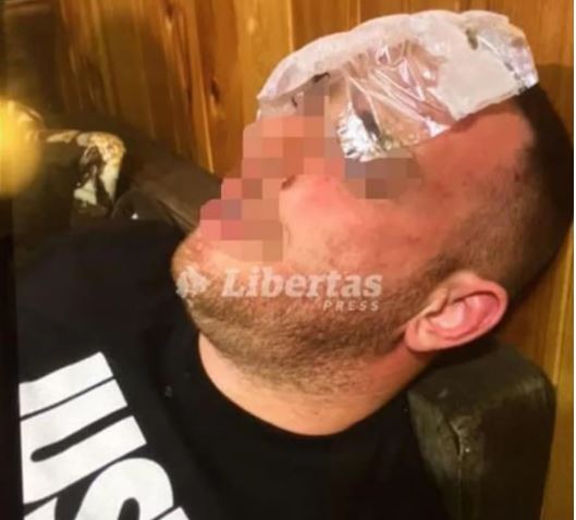 KLUPKO SE ODMOTAVA: Otkriven identitet još jedne žrtve policijske torture (FOTO)