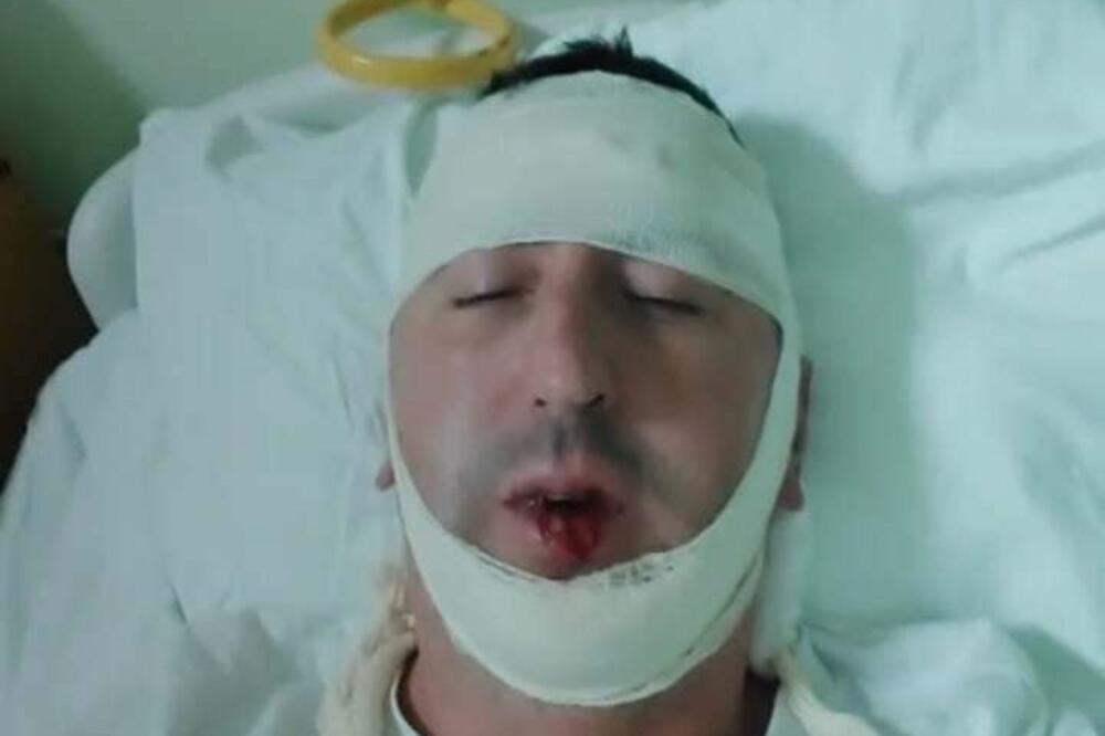 UZNEMITUJUĆI SNIMAK NAPADA NA PAVIĆEVIĆA U NIKŠIĆU: Vandali uništavali gradski inventar pa nasrnuli na Boška (VIDEO)