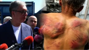 Vučić o brutalnom prebijanju Raškovića: Njegova leđa su lice Aljbina Kurtija